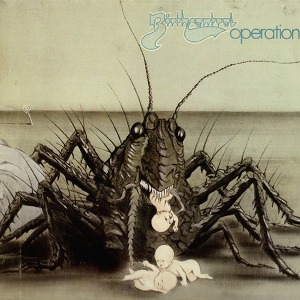 Birth Control Operation